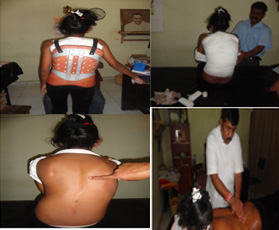 SCOLIOSIS Special Ayurveda Treatments Sri Lanka